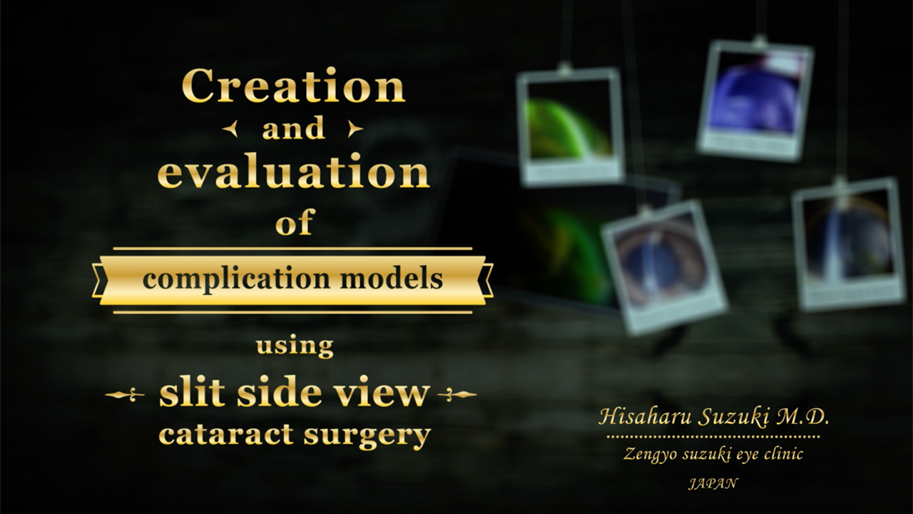 Creation and Evaluation of Complication Models Using Slit Side View Cataract Surgery