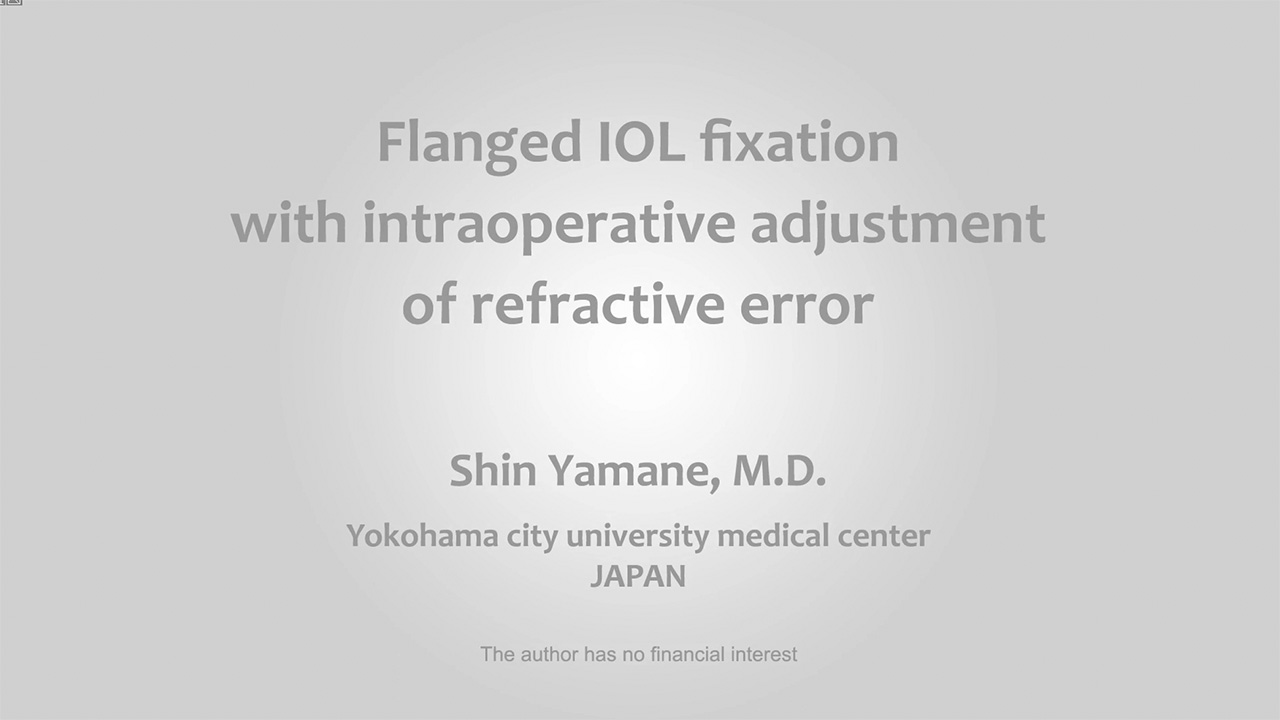 Flanged IOL fixation with intraoperative adjustment of refractive error
