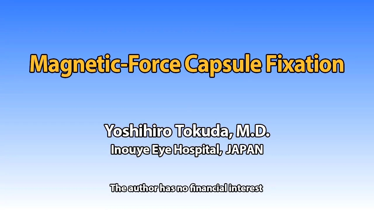 Magnetic-Force Capsule Fixation